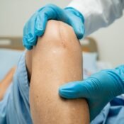Knee Issues