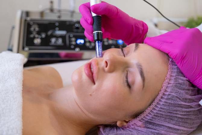 Micro Needling Facial