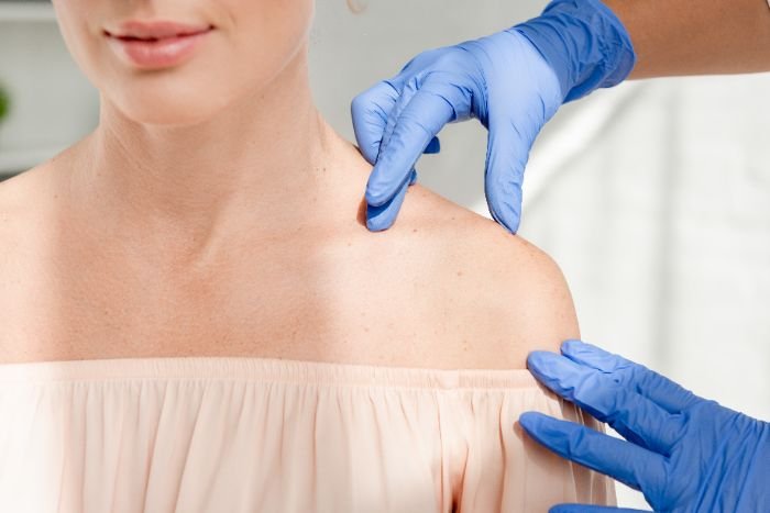 resized_cropped-view-of-dermatologist-examining-skin-of-pa-2024-11-15-12-15-51-utc